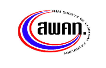 Awan